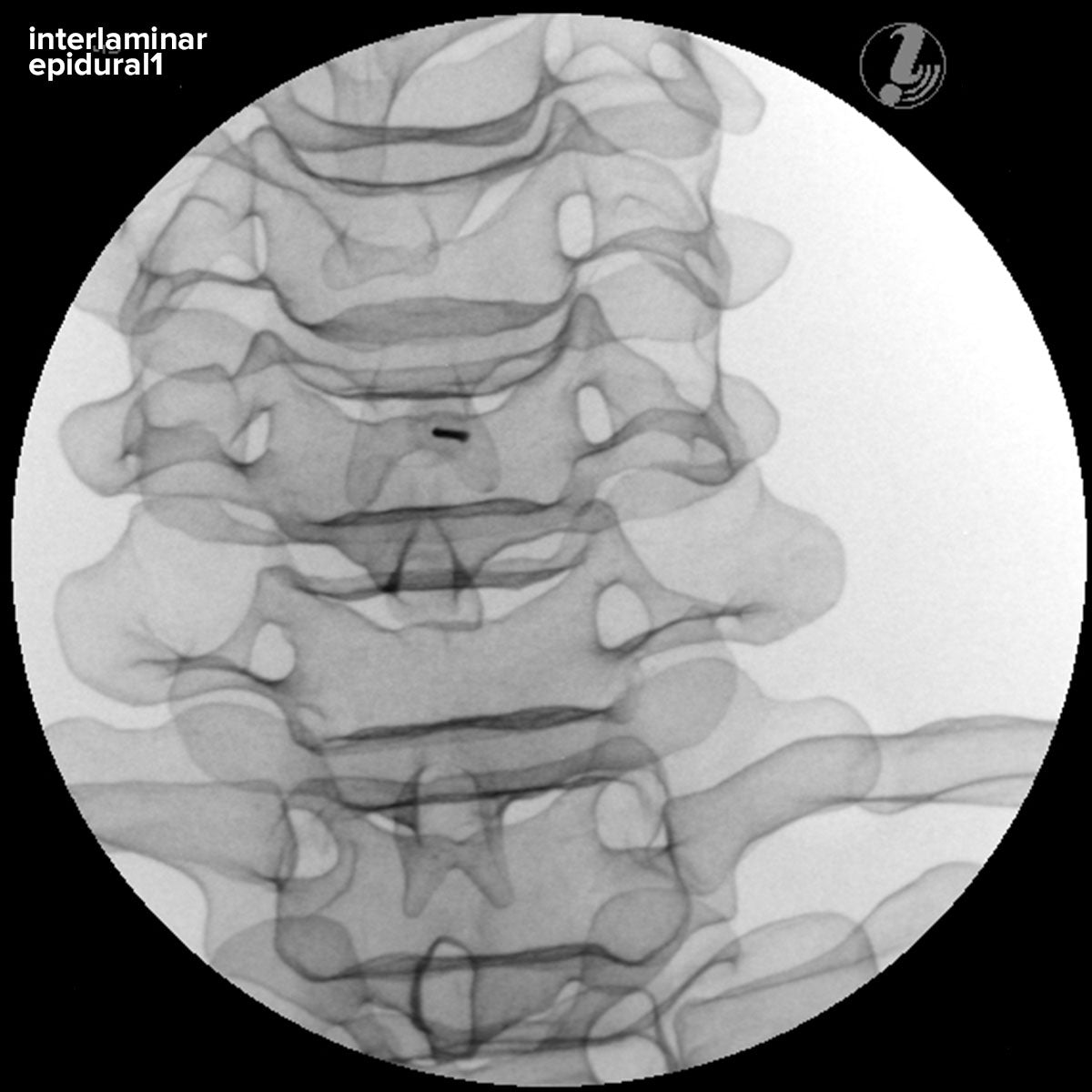 Image Guided Lumbar Spinal Injection Trainer P65