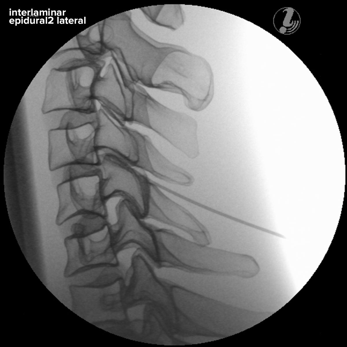 Image Guided Lumbar Spinal Injection Trainer P65