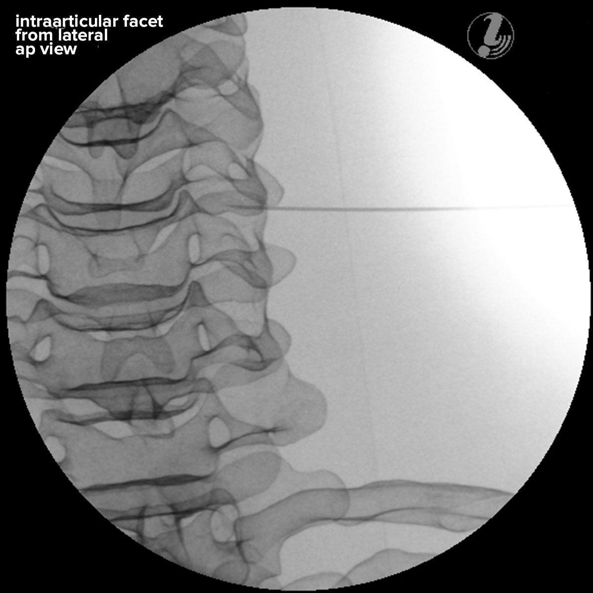 Image Guided Lumbar Spinal Injection Trainer P65