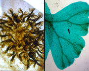 Microscope Slide, Plant; Fern Life Cycle Composite, Showing Prothallium, Young Sporophyte, Sporangia