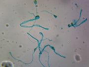 Microscope Slide, Moss Protonema, W.M.