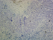 Microscope Slide, Root Legume Nodule Section, Showing Nitrogen Fixing Bacteria into the Nodules