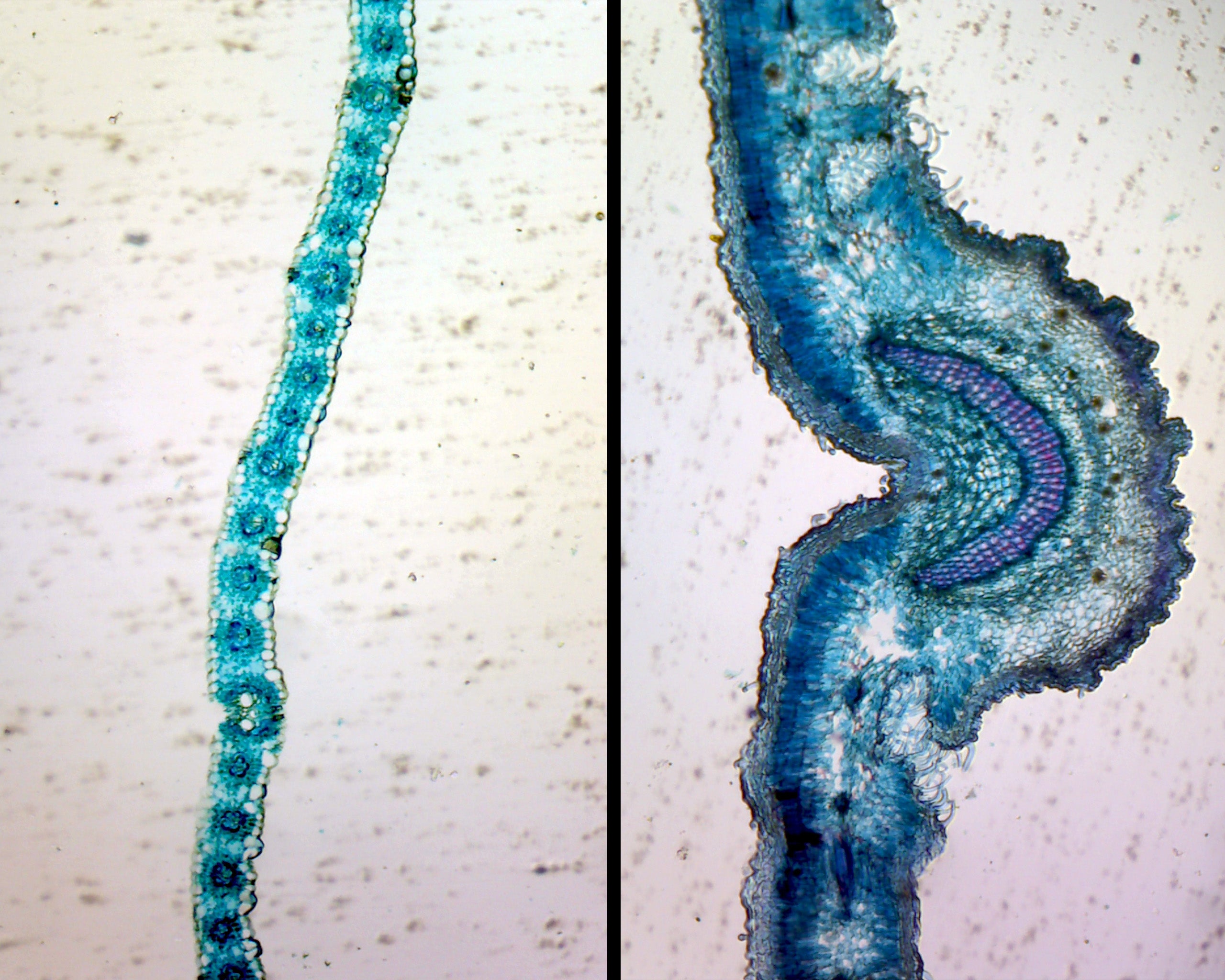 Microscope Slide, Monocot & Dicot Leaf Epidermis in Comparison; W.M. showing Lilium and Sedum