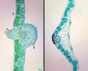 Microscope Slide, Angiosperms Roots, Dicot Root, C.S., General Structure