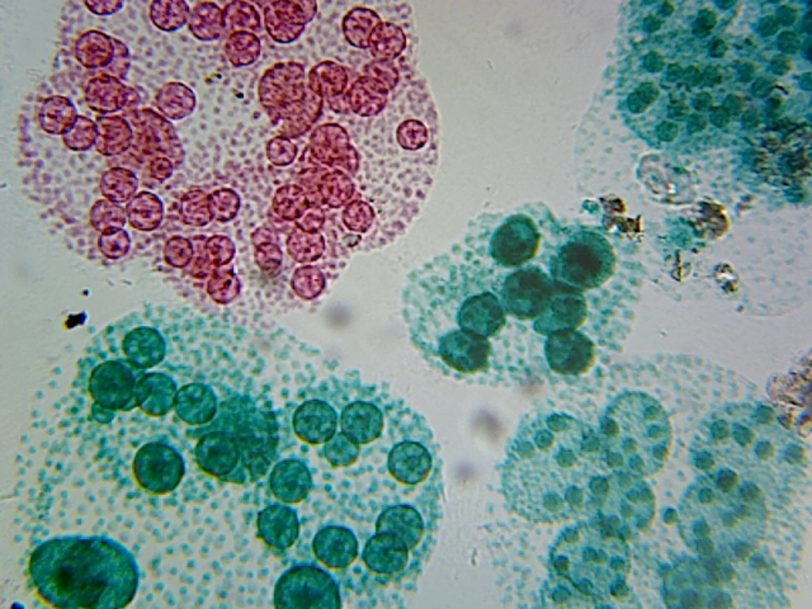 Microscope Slide, Chlorophyta Green Algae, Volvox, Asexual, Reproduction W.M. Colonial Algae showing Daughter Colonies