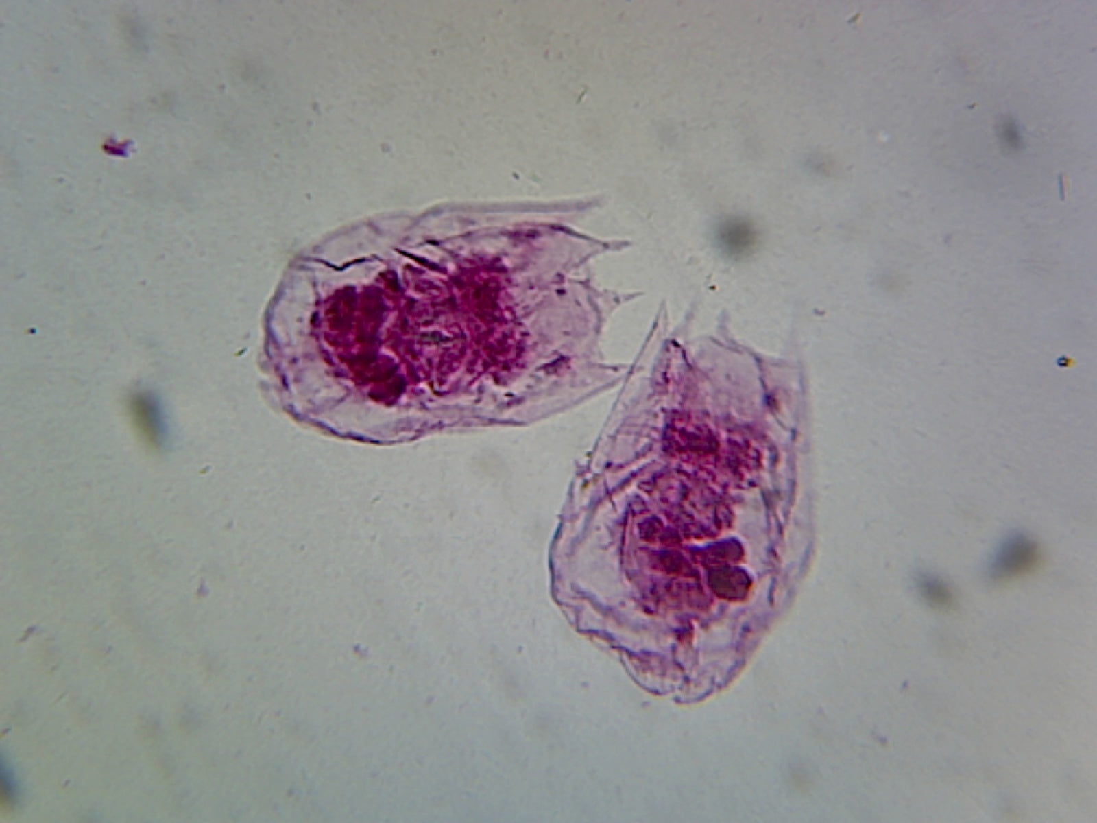 Microscope Slide, Vorticella, W.M. Peritrich ciliate, bell-shaped, contractile stalk
