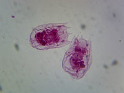 Microscope Slide, Vorticella, W.M. Peritrich ciliate, bell-shaped, contractile stalk