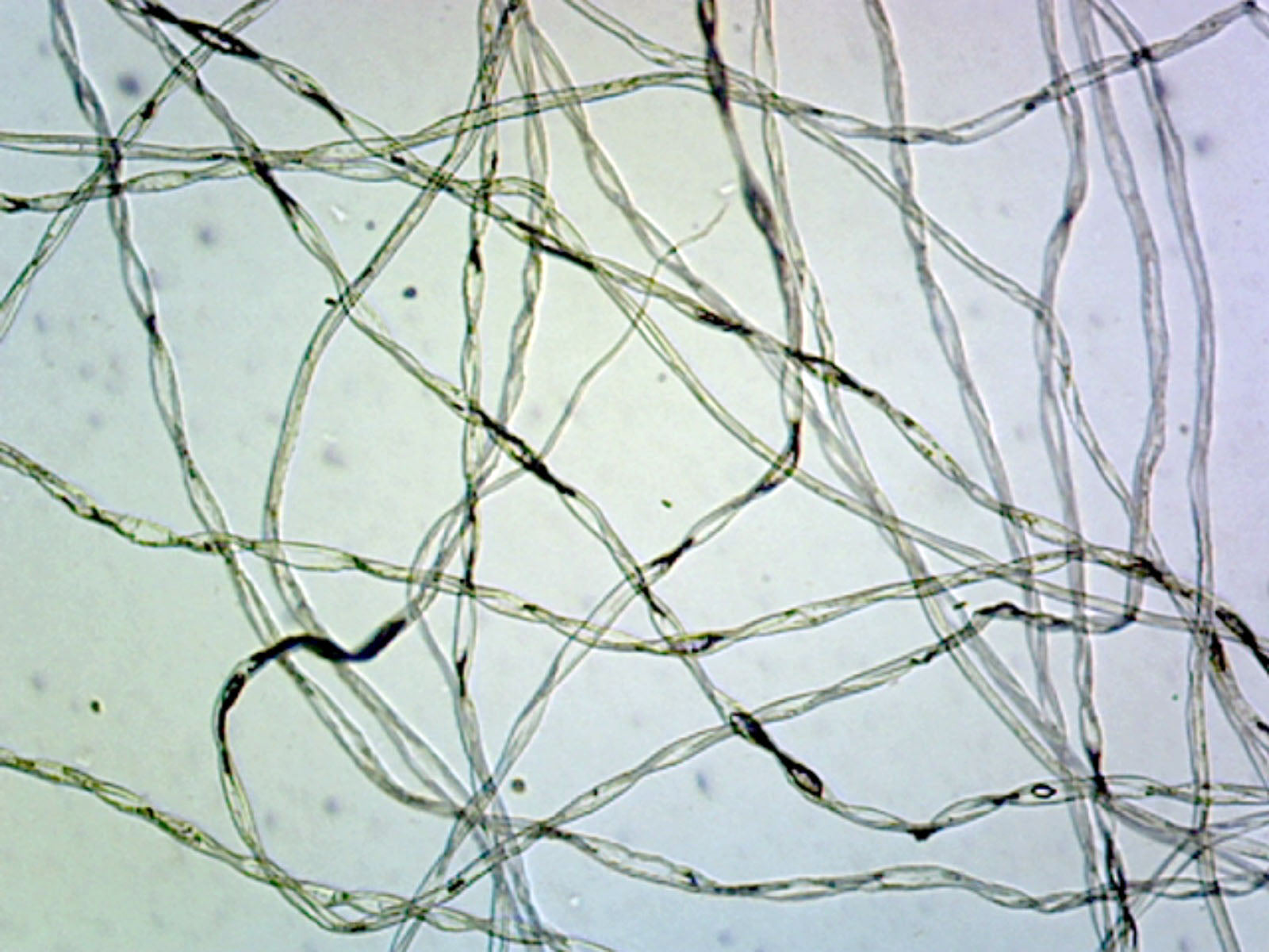 Microscope Slide, Cotton W.M Textile Fibers