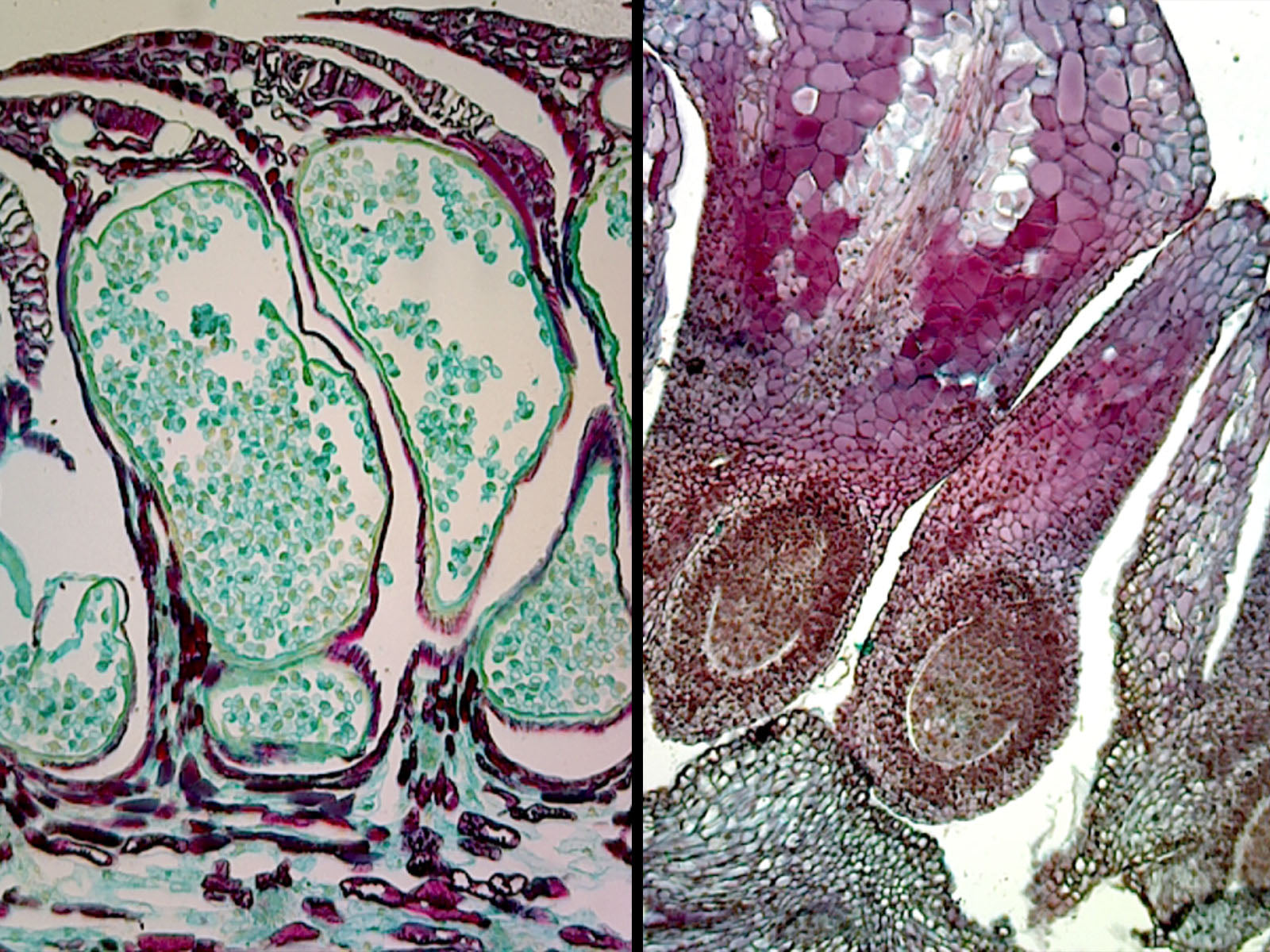 Microscope Slide, Pine Life History Composite showing: root C.S., stem C.S., leaf C.S., female cone L.S. and male cone L.S.
