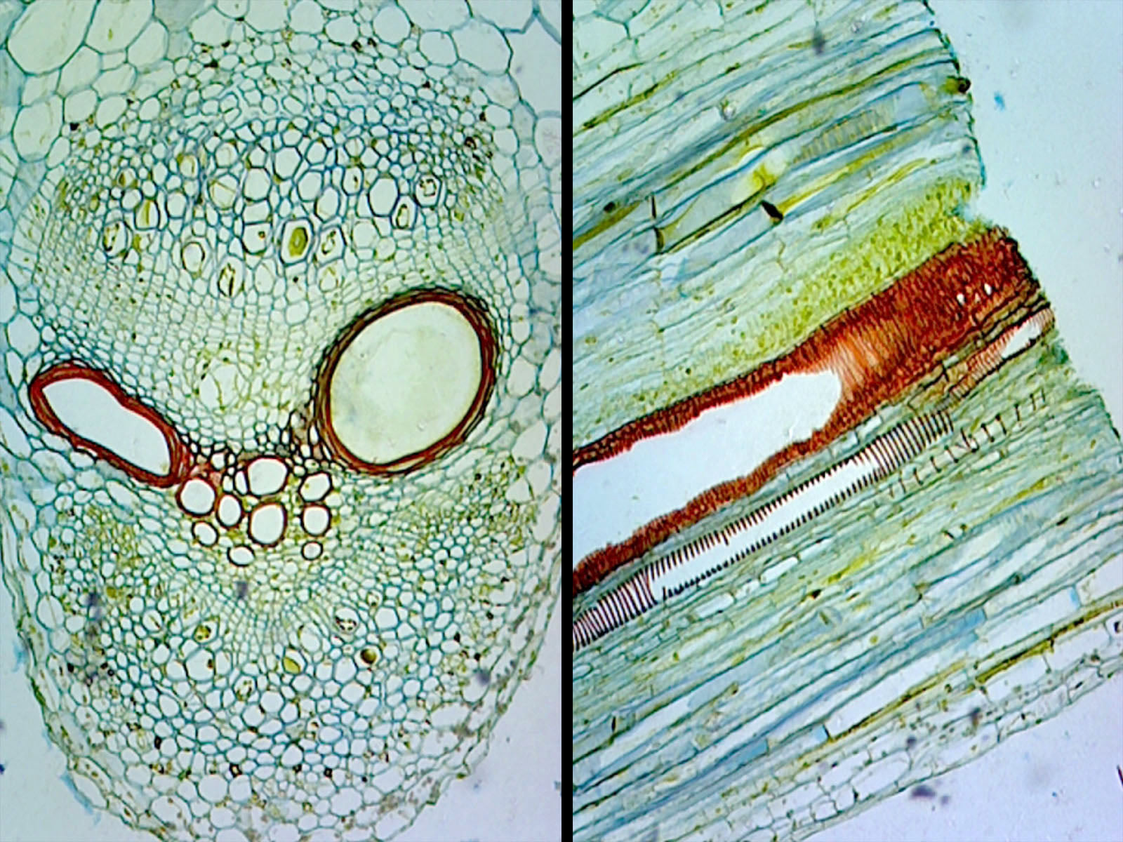 Microscope Slide, Pumpkin Stem C.S. & L.S. Cucurbita