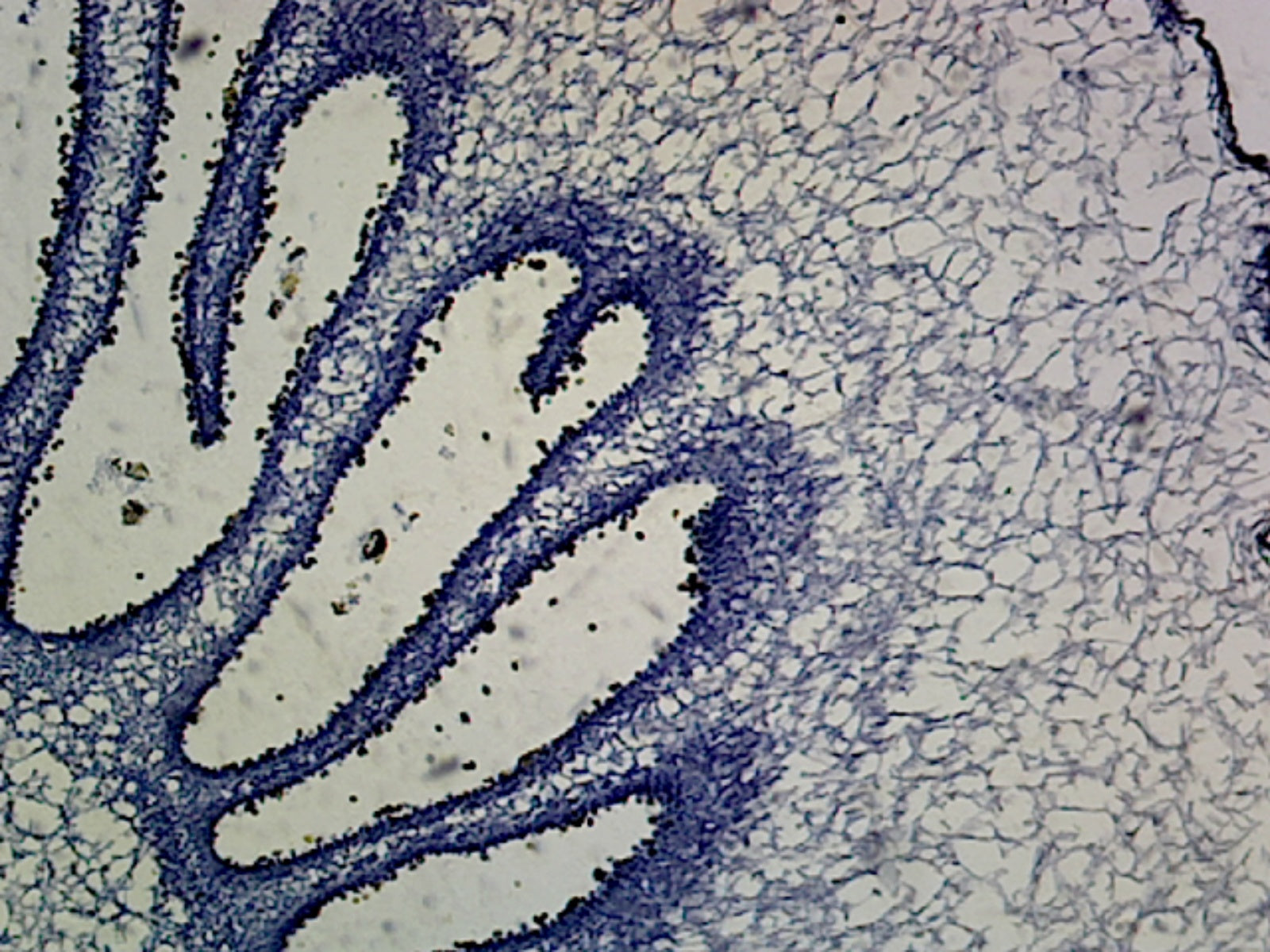 Microscope Slide, Fungi, Coprinus Mushroom Anatomy, C.S. Dimorphic Fungus, Showing Pileups, Gills and Spores