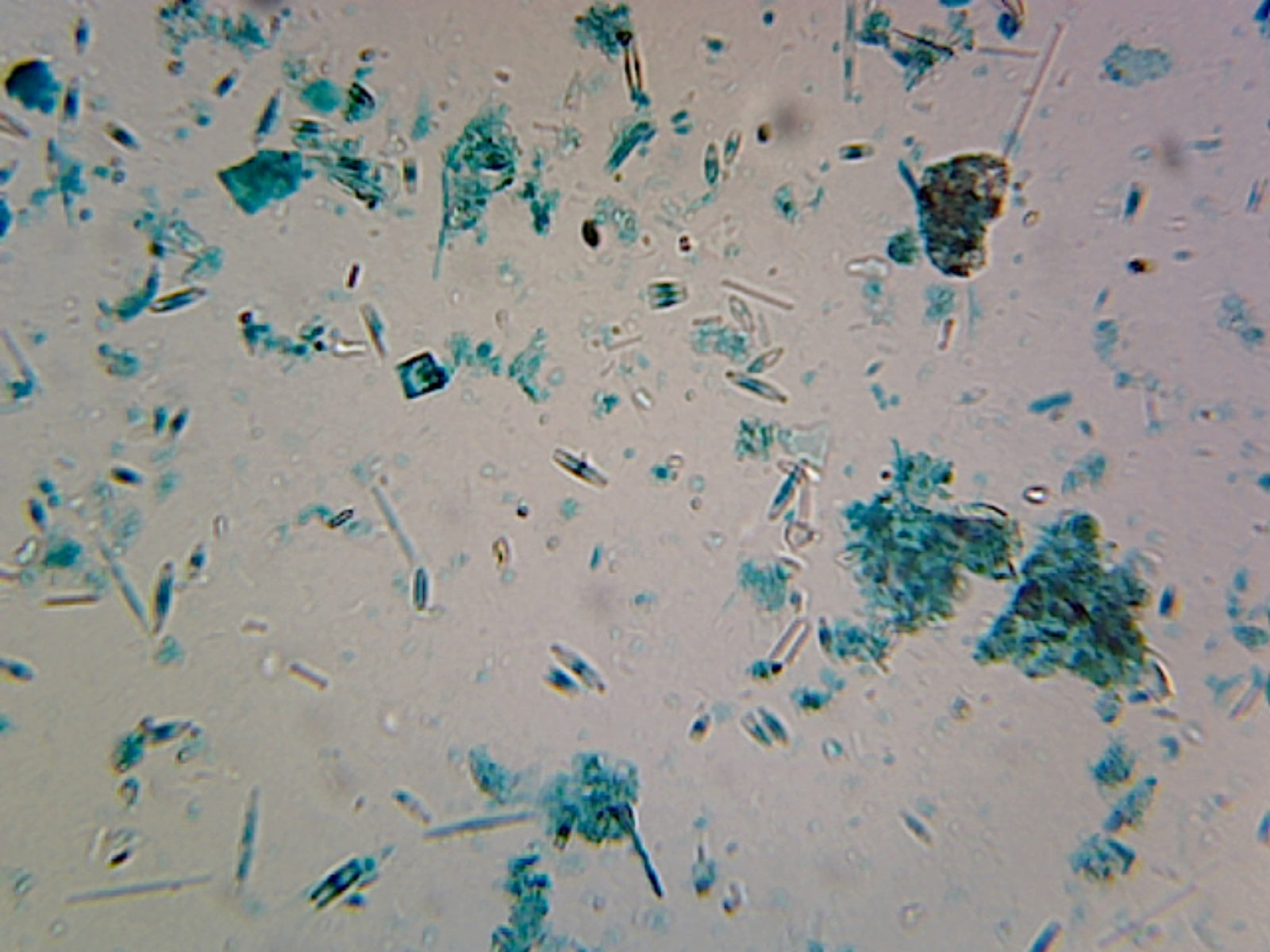 Microscope Slide, Fungi; Mixed Diatoms; Whole mount; Showing various types in comparison