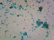 Microscope Slide, Fungi; Mixed Diatoms; Whole mount; Showing various types in comparison