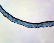 Microscope Slide, Lichen; Section; Symbiotic Fungi; Thallus Shows Algal Cell Surrounded by Fungal Hyphae