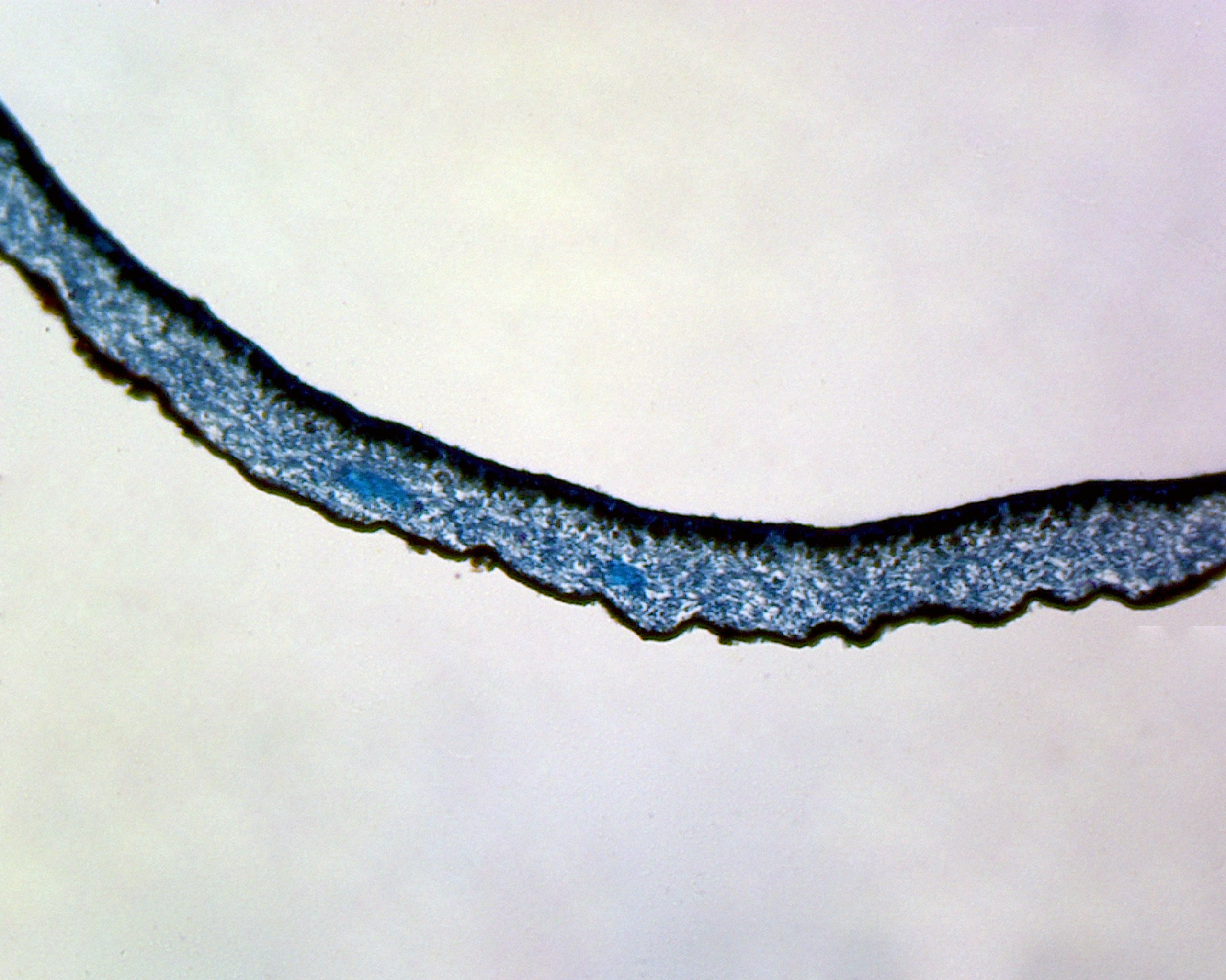 Microscope Slide, Lichen; Section; Symbiotic Fungi; Thallus Shows Algal Cell Surrounded by Fungal Hyphae
