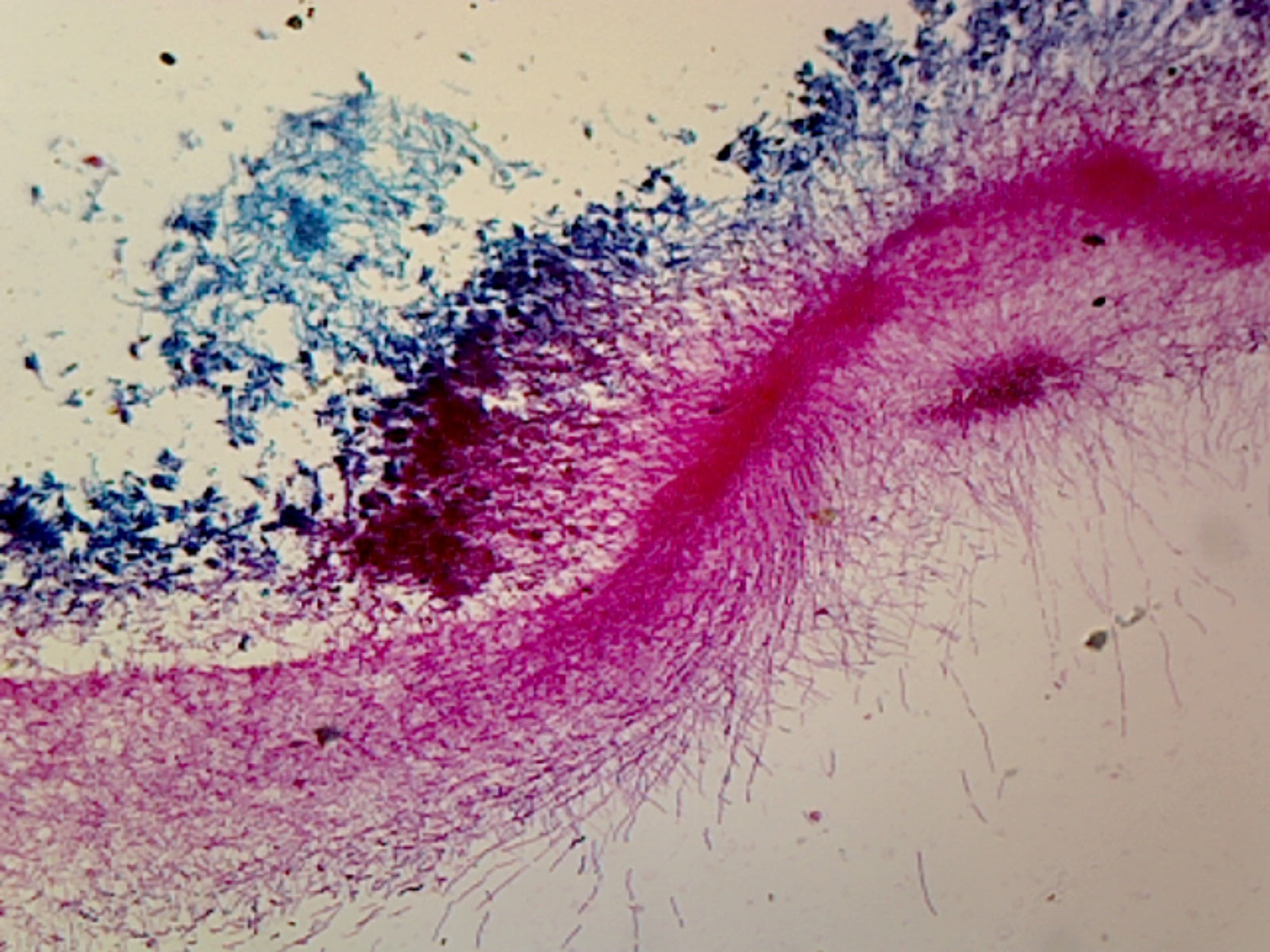 Microscope Slide, Penicillium W.M. most commonly found in soil, cellulose materials, foods and grains.