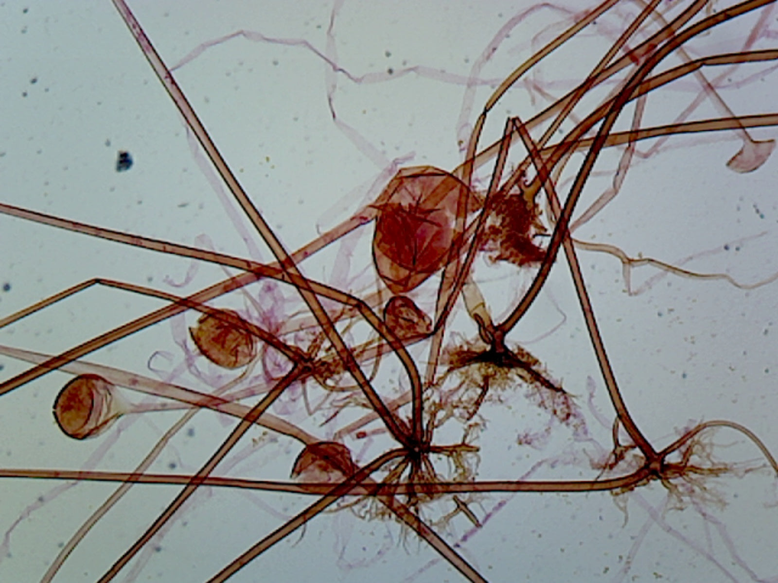 Microscope Slide, Rhizopus Asexual Reproduction, W.M. Filamentous Fungus Found in Soil Decaying Fruits and Vegetables