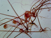 Microscope Slide, Rhizopus Asexual Reproduction, W.M. Filamentous Fungus Found in Soil Decaying Fruits and Vegetables