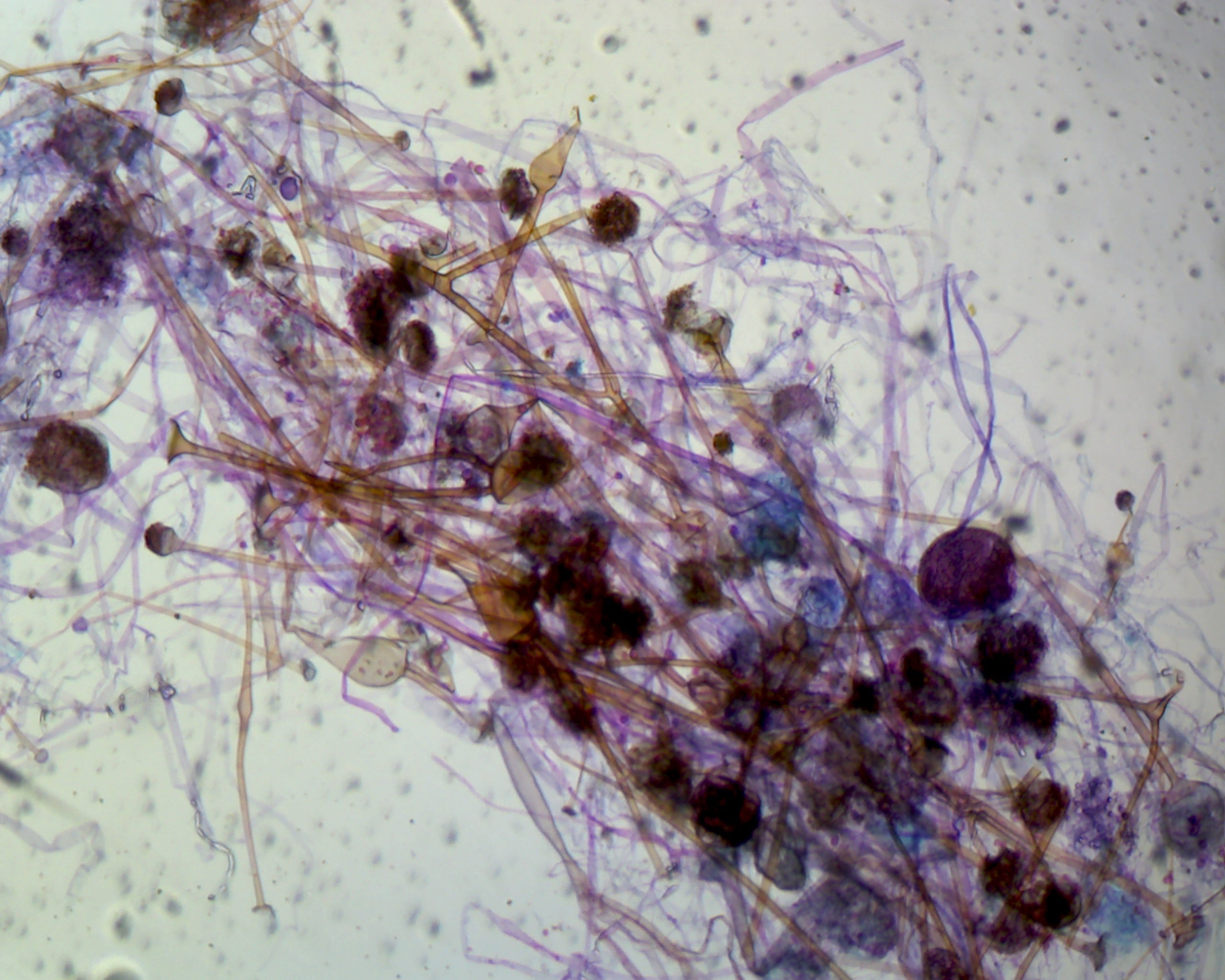 Microscope Slide, Rhizopus Sporangia W.M. Asexual