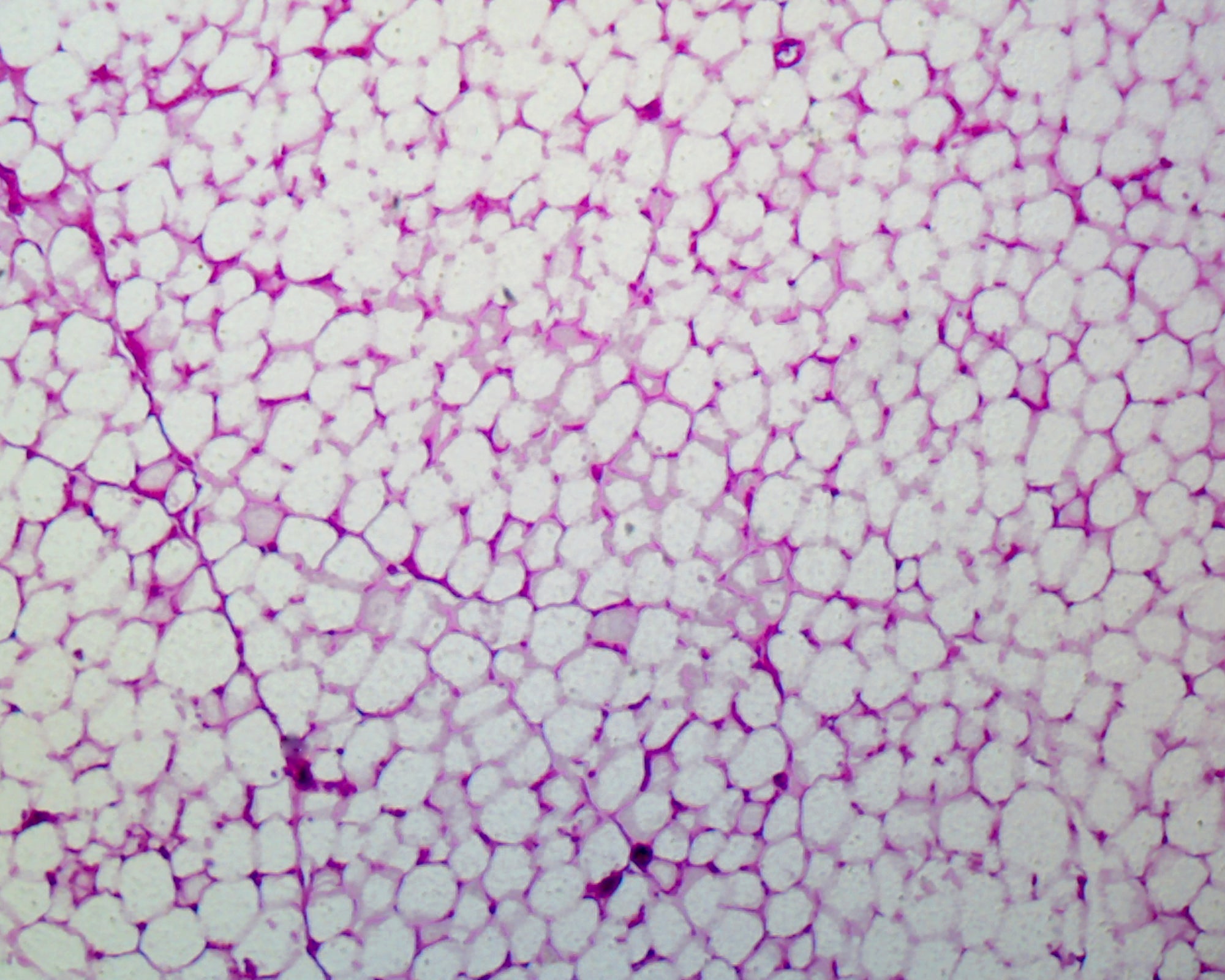 Microscope Slide, Adipose Tissue Section, Human