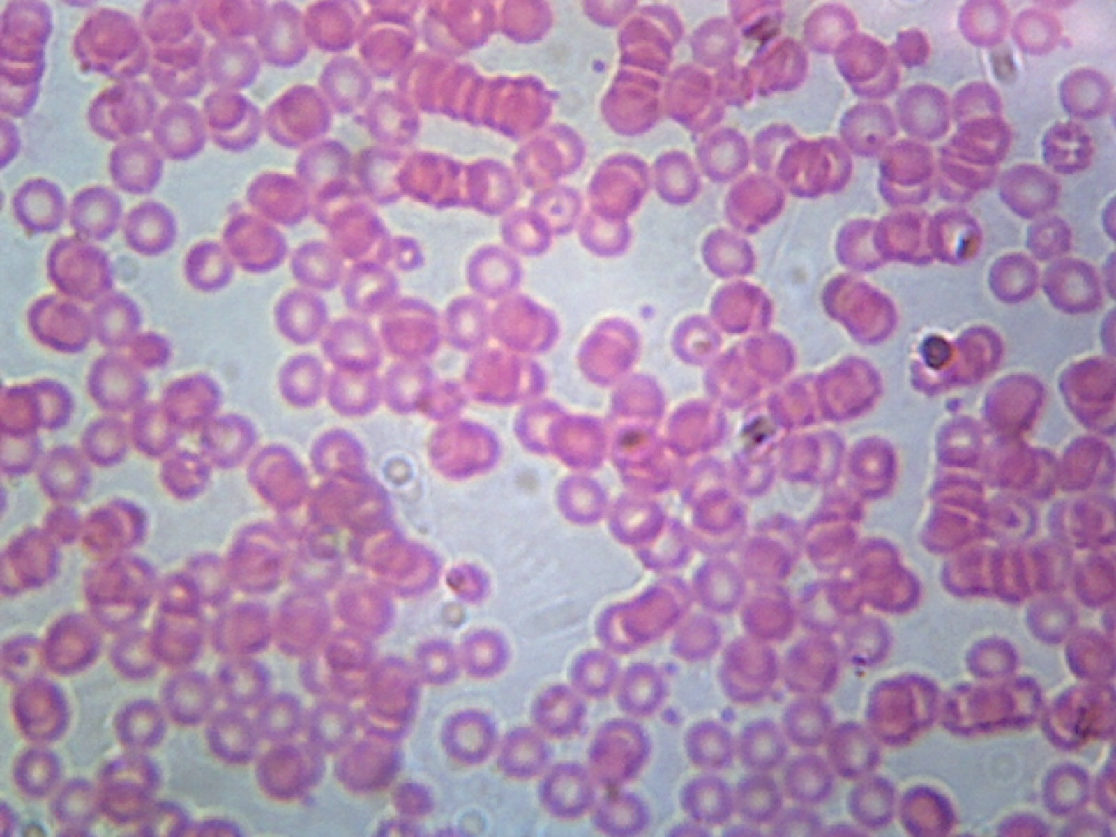 Microscope Slide, Blood Smear H&E Stain Human