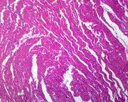 Microscope Slide, Cardiac, Striated Muscle C.S. H&E Stain, Human