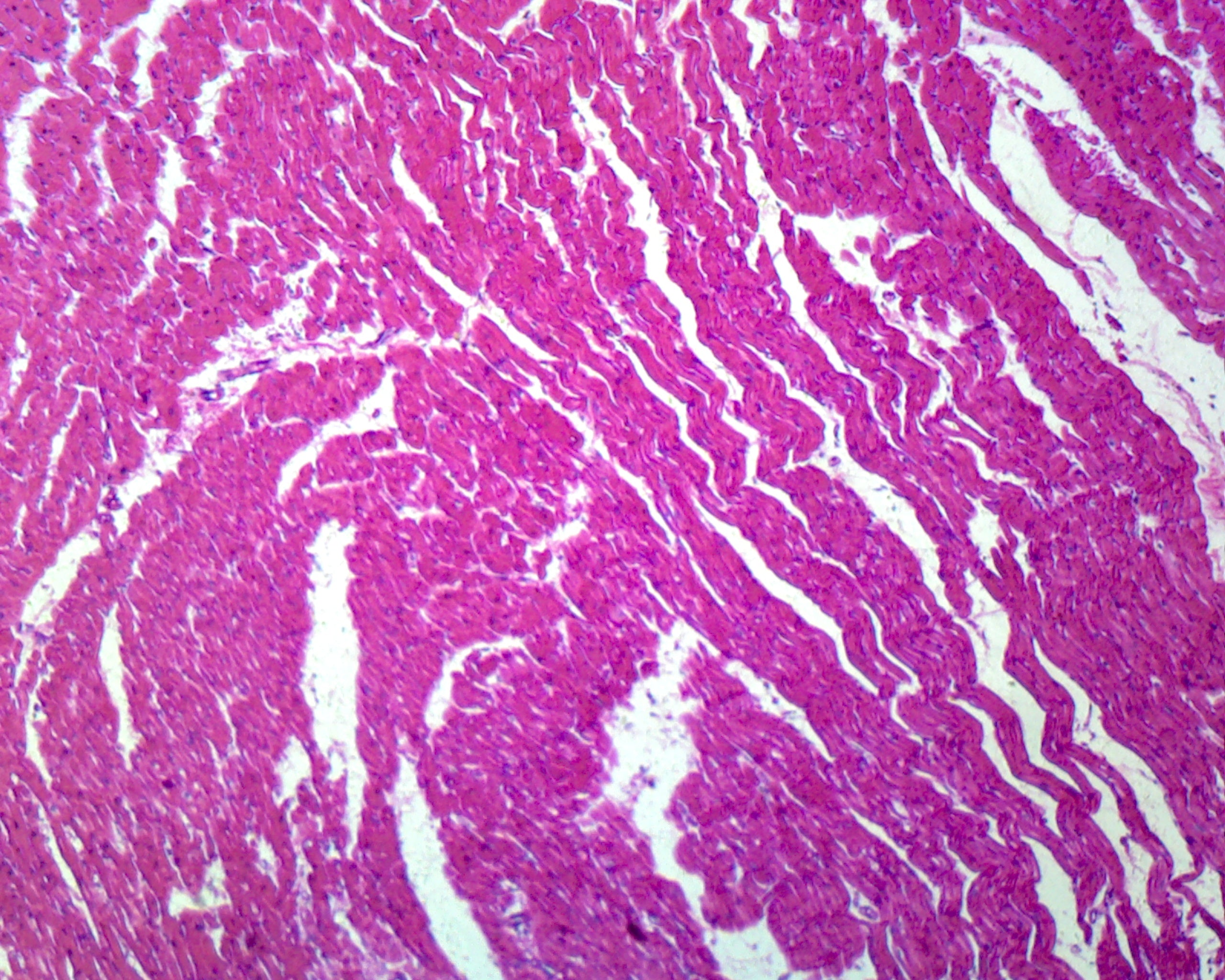 Microscope Slide, Cardiac, Striated Muscle C.S. H&E Stain, Human