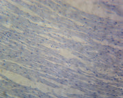Microscope Slide, Cardiac Striated Muscle; L.S. Mammal