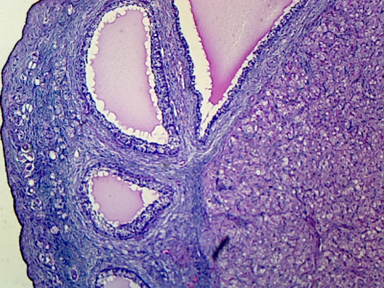 Microscope Slide, Corps Luteum Section Mammalian