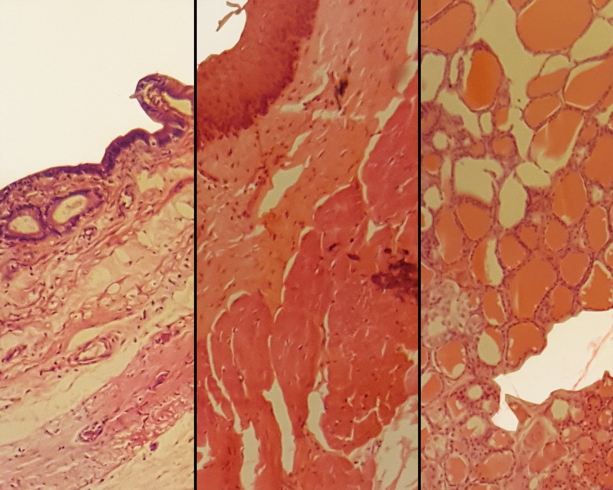 Microscope Slide, Epithelium Composite Sec. Mammal, Section of Stratified Squamous, Columnar and Cuboidal Epithelium in same slide