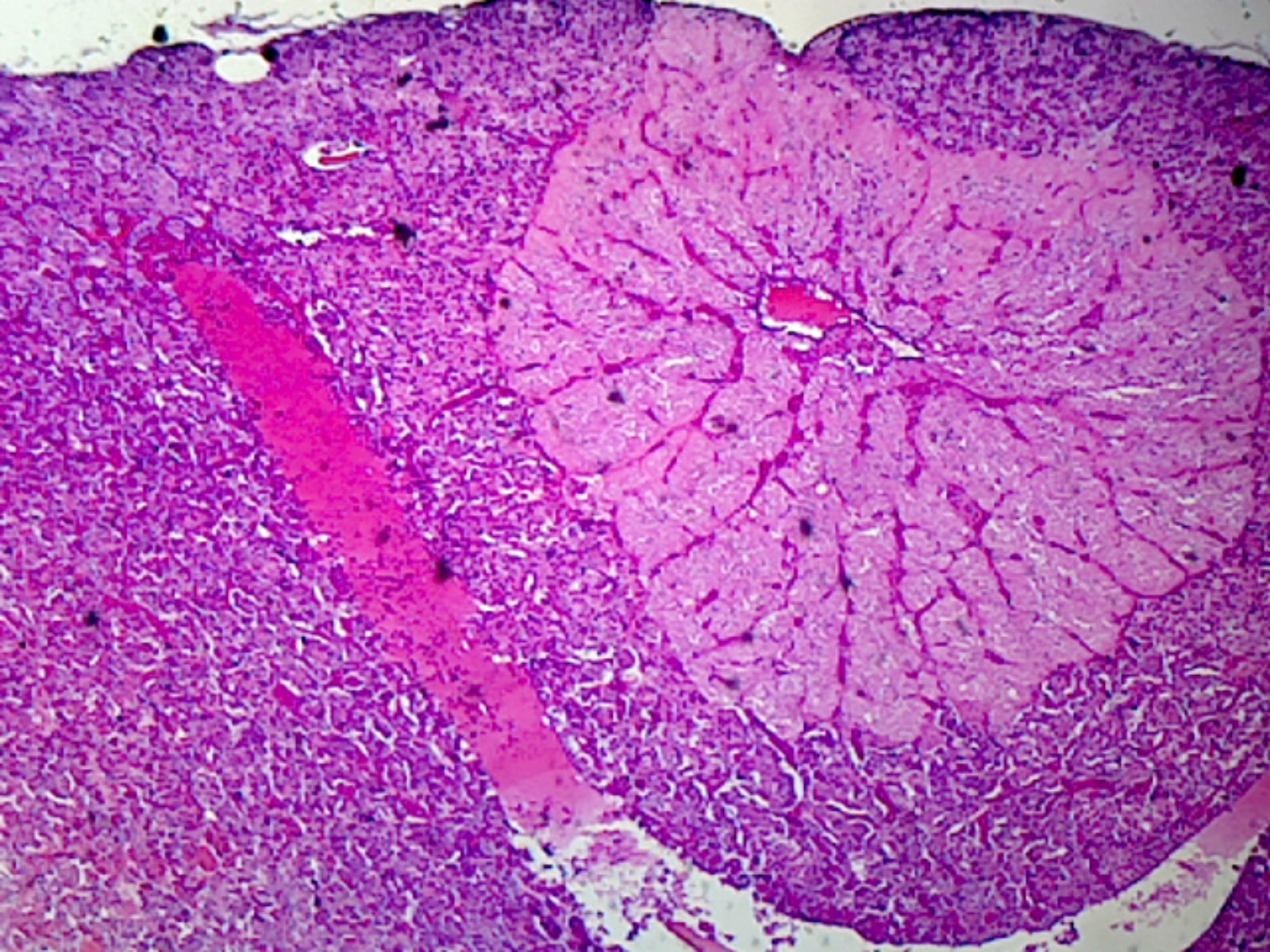Microscope Slide, Endocrine System, Hypophysis Section.