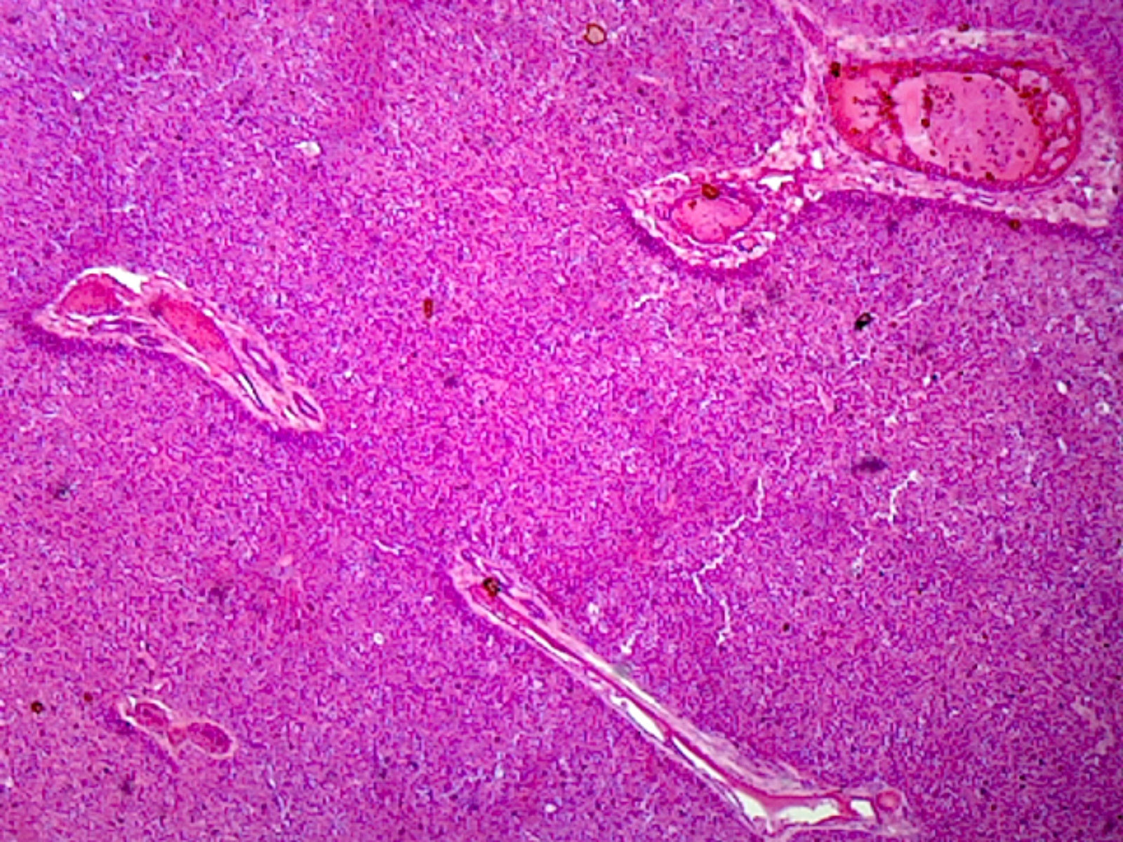Microscope Slide, Liver Section. Mammal, Showing Hepatic Cells, H&E Stain