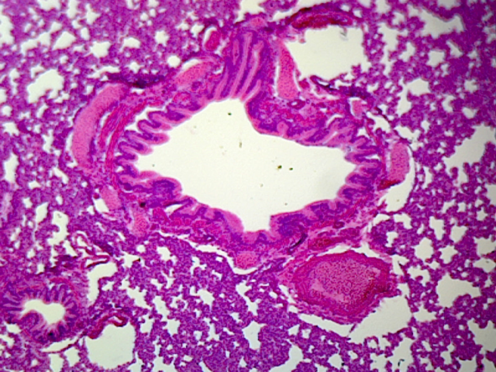 Microscope Slide, Lung Section