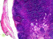Microscope Slide, Lymph Node Sec. Mammal