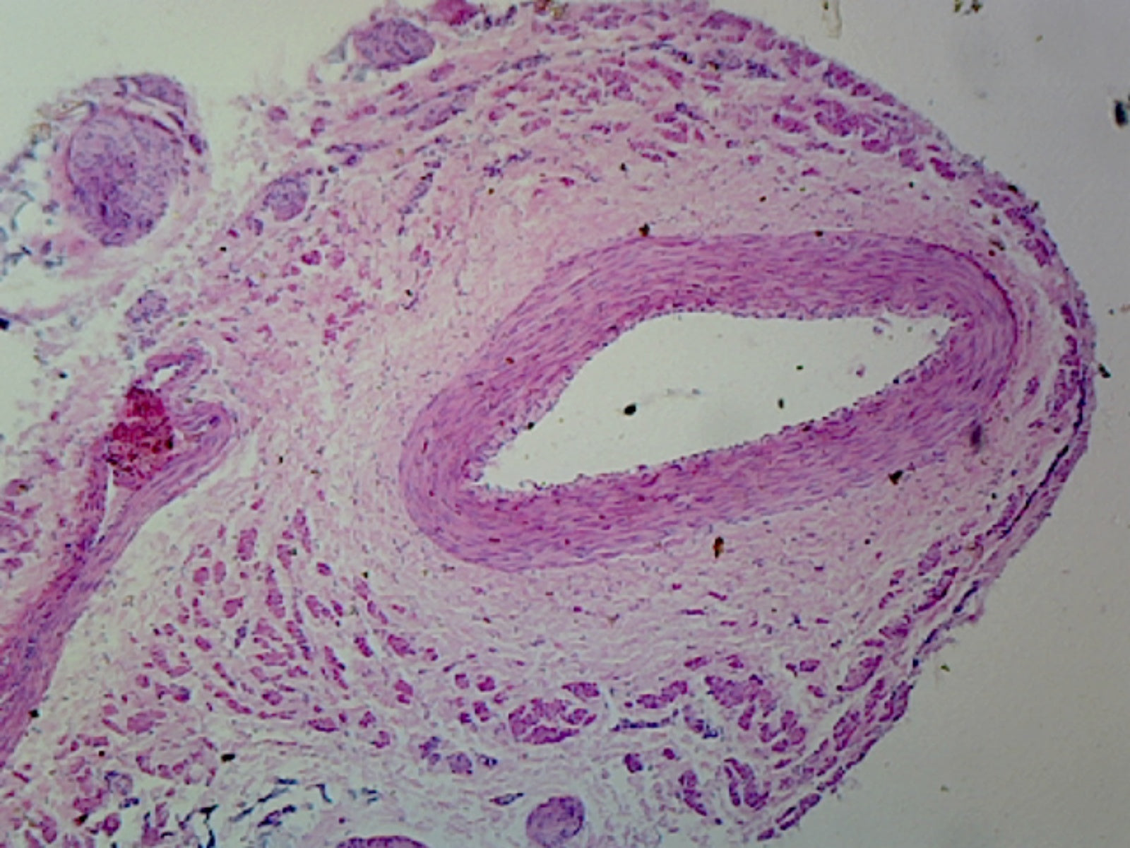 Microscope Slide, Medium Sized Artery and Vein