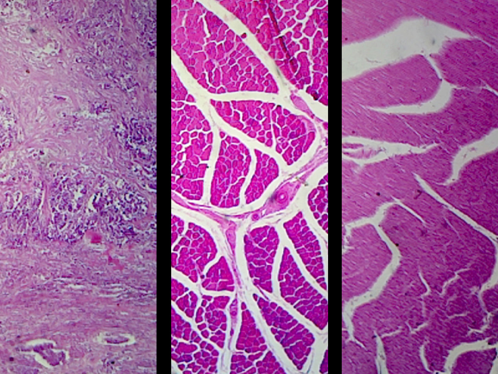 Microscope Slide, Muscle Types Composite Sec., H&E Stain, Mammal, Showing Smooth, Cardiac and Striated Skeleton Muscle