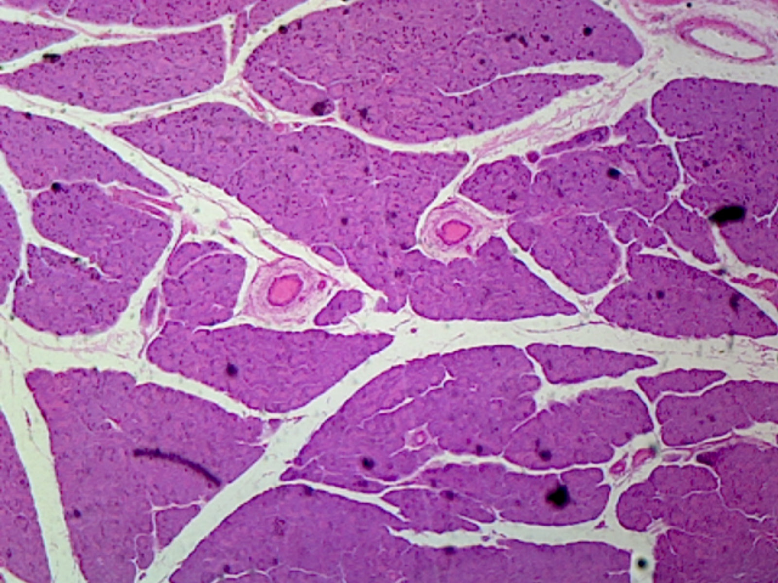 Microscope Slide, Pancreas, Sec. Mammal, Showing Acini Ducts and Islets of Langerhans