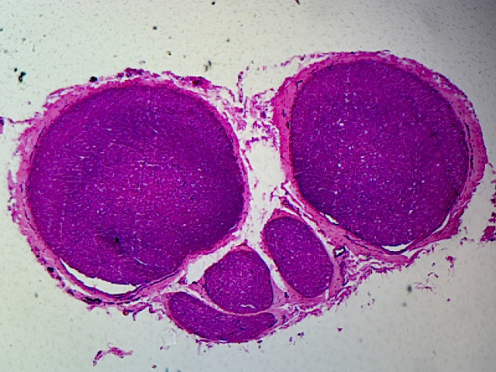Microscope Slide, Peripheral Nerve, C.S. Mammal, Myelinated