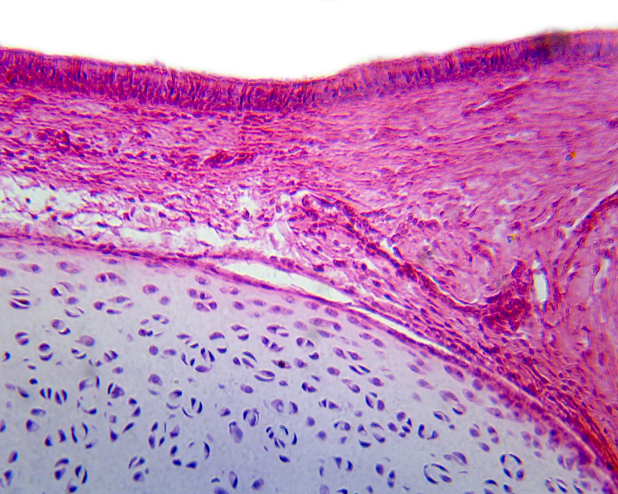 Microscope Slide, Pseudostratified Columnar Ciliated Epithelium, Section, Mammal From Respiratory System Tissue H&E Stain