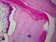 Microscope Slide, Red Bone Marrow Sec., H&E Stain, Mammal, Showing Giant Blood Cells