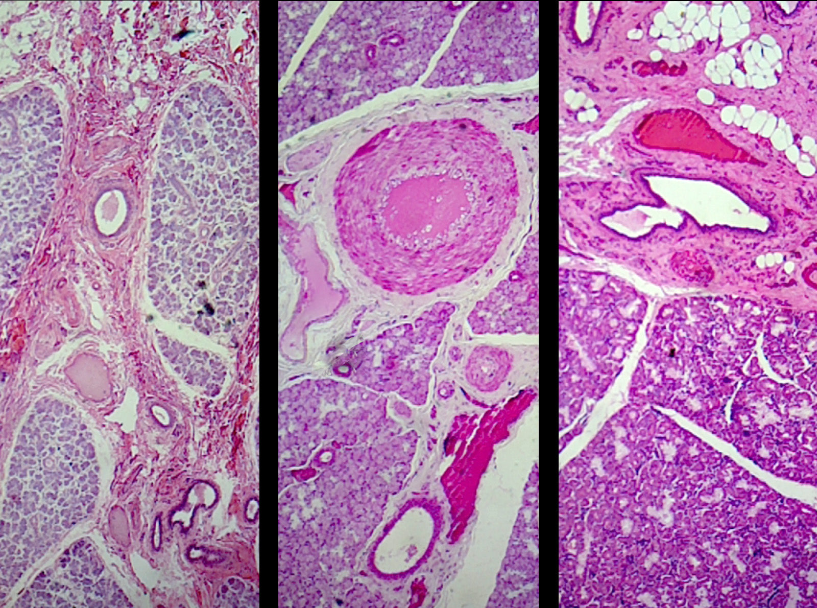 Microscope Slide, Salivary Glands Composite Sec., H&E Stain Mammal, Showing Sublingual Submaxillary and Parotid Gland in Comparison