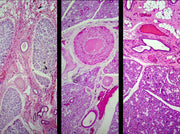 Microscope Slide, Salivary Glands Composite Sec., H&E Stain Mammal, Showing Sublingual Submaxillary and Parotid Gland in Comparison