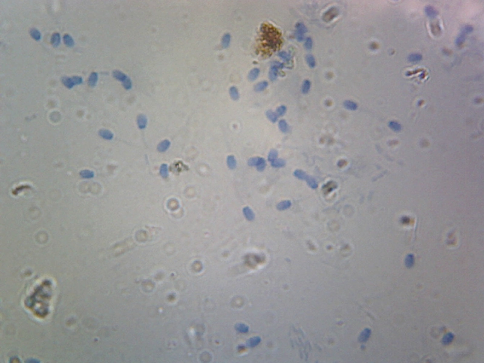 Microscope Slide, Sperm Smear Mammalian