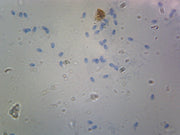 Microscope Slide, Sperm Smear Mammalian