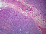 Microscope Slide, Spleen Sec., H&E Stain, Human