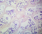 Microscope Slide, Spongy Bone Section Mammal