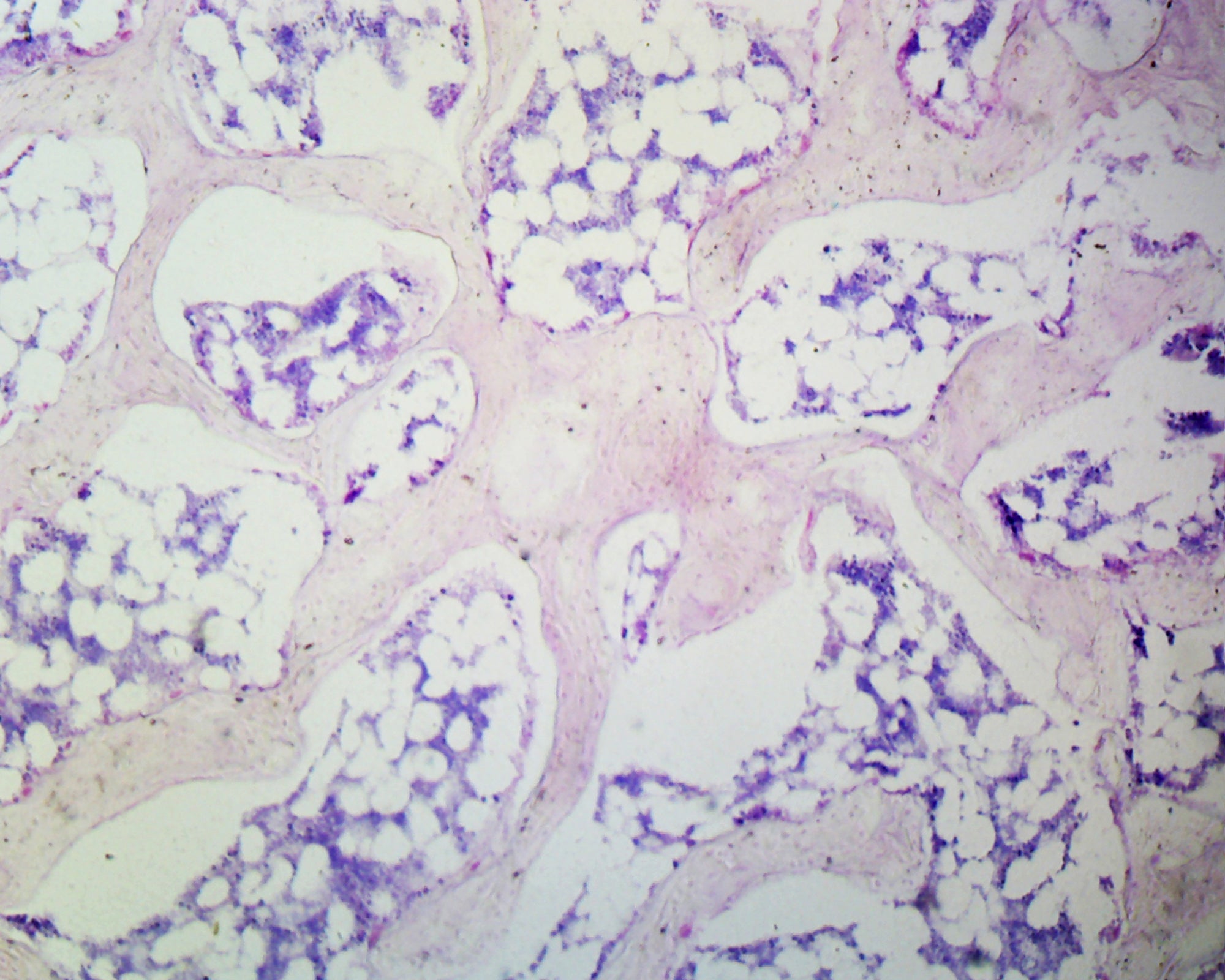 Microscope Slide, Spongy Bone Section Mammal