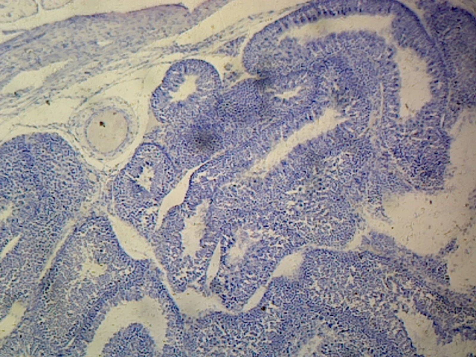 Microscope Slide, Testis Section, Human
