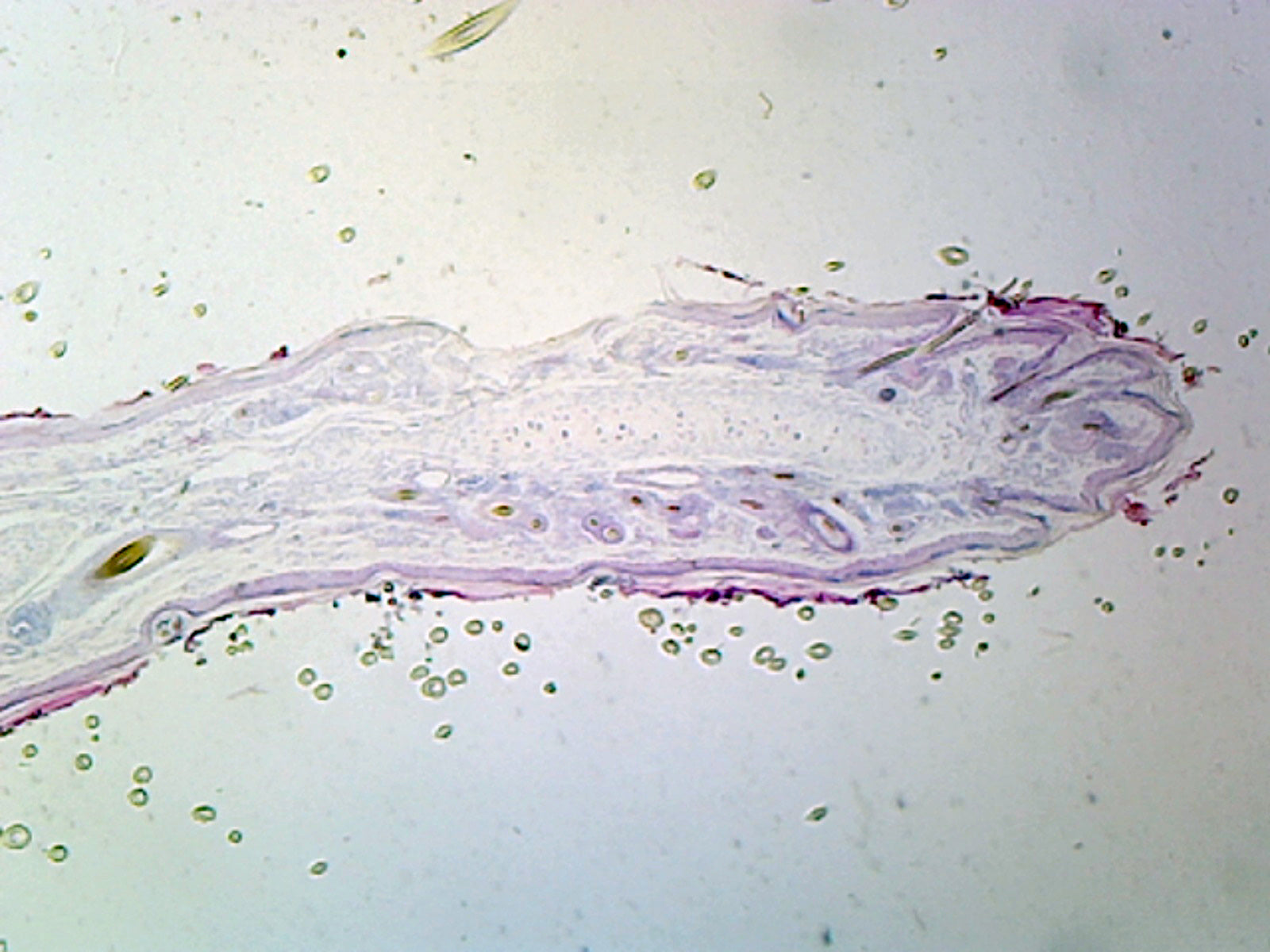 Microscope Slide, Yellow Elastic Cartilage, Sec. Mammal, Showing Elastic Fibers