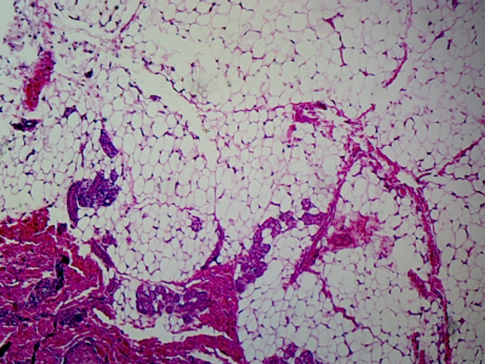 Microscope Slide, Adipose Tissue Sec. H&E Stain, Mammal